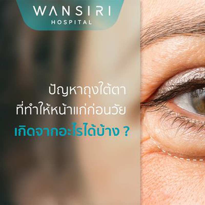 ปัญหาถุงใต้ตา เกิดจากอะไรได้บ้าง?