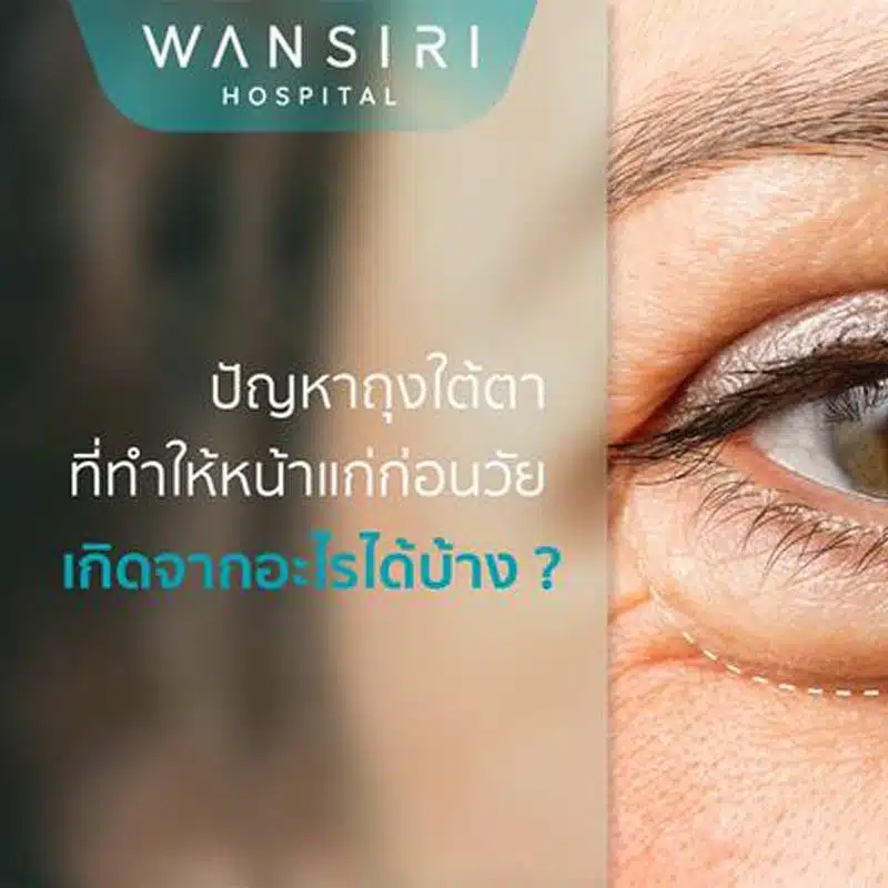 ปัญหาถุงใต้ตา เกิดจากอะไรได้บ้าง?