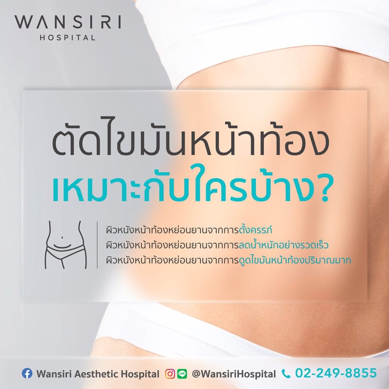 Abdominal liposuction is suitable for…?