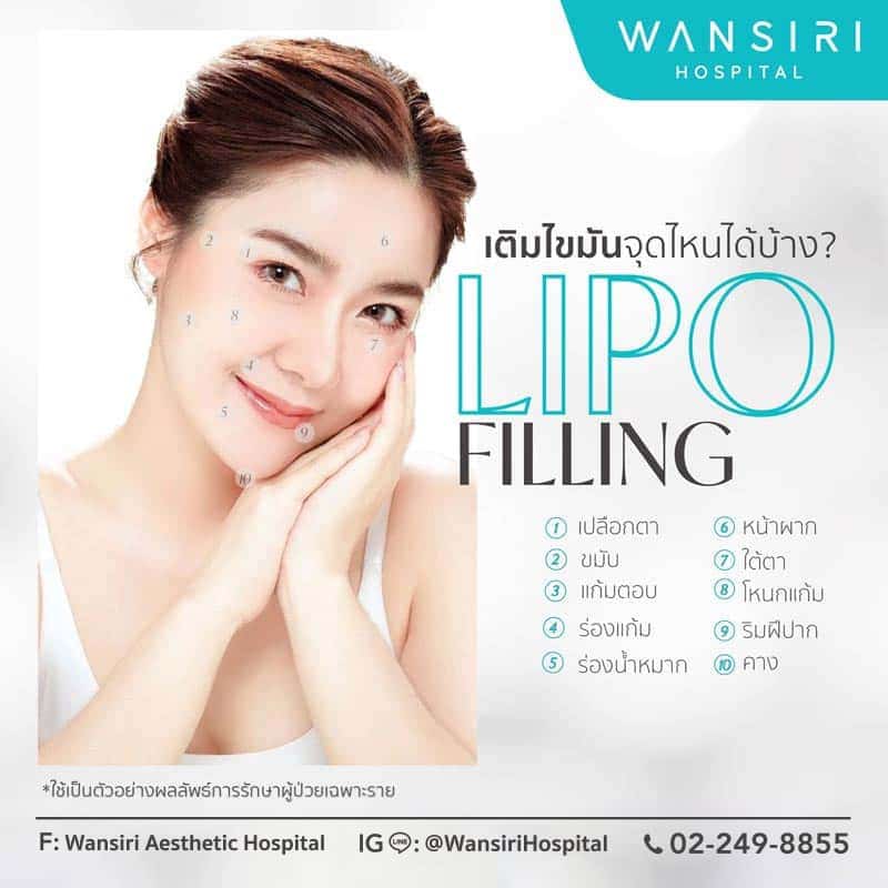 Lipo Filling เติมไขมันจุดไหนได้บ้าง