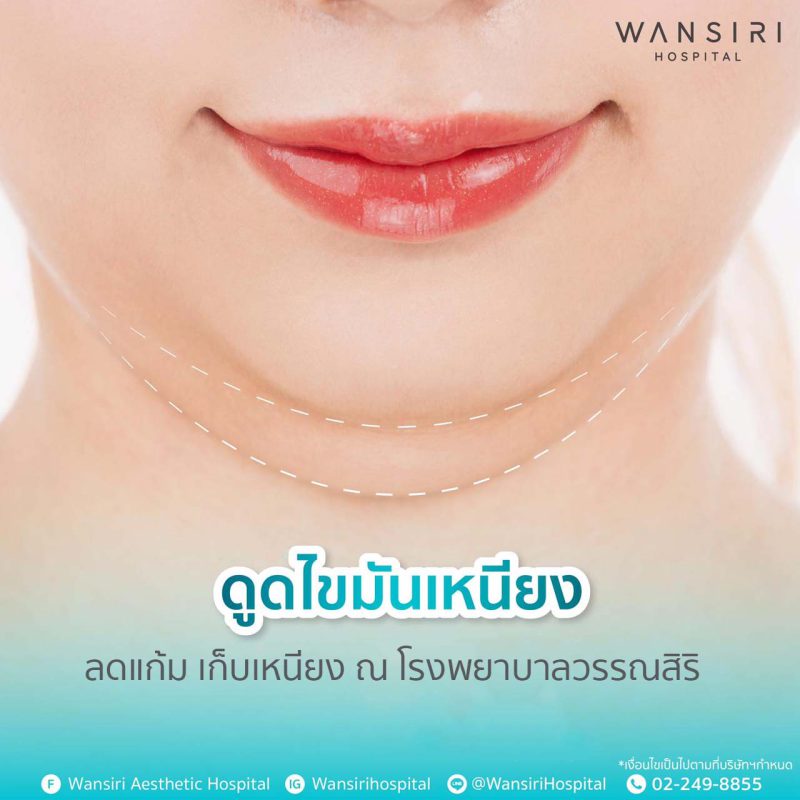 แก้มเยอะ เหนียงย้อย กำจัดได้ง่าย ๆ ด้วยวิธีการดูดไขมัน