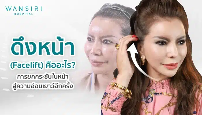 ดึงหน้า Facelift คืออะไร