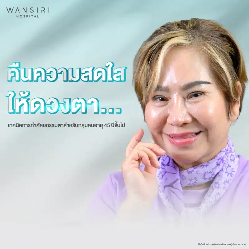 เทคนิคการทำศัลยกรรมตาสำหรับกลุ่มคนอายุ 45 ปีขึ้นไป : คืนความสดใสให้ดวงตา