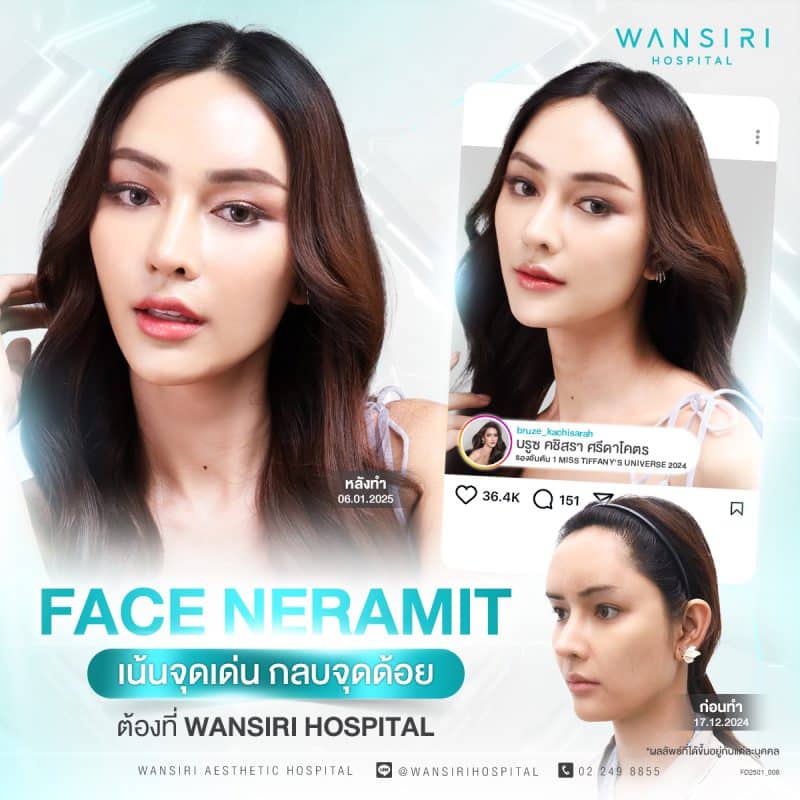 รีวิวกรอโหนก ยุบโหนก