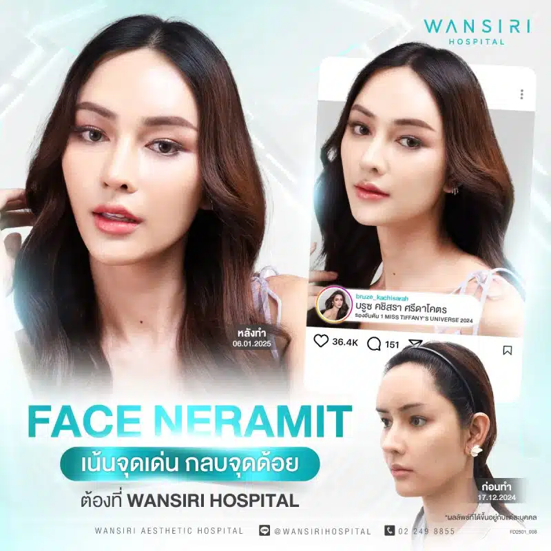 รีวิวยุบหน้าผาก กรอโหนกคิ้ว